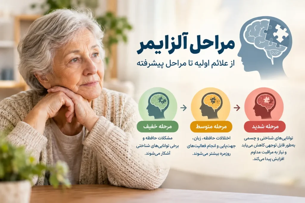مراحل آلزایمر از خفیف تا شدید